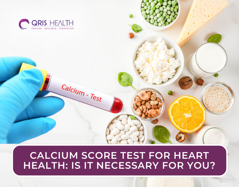 Calcium Serum Test in Delhi